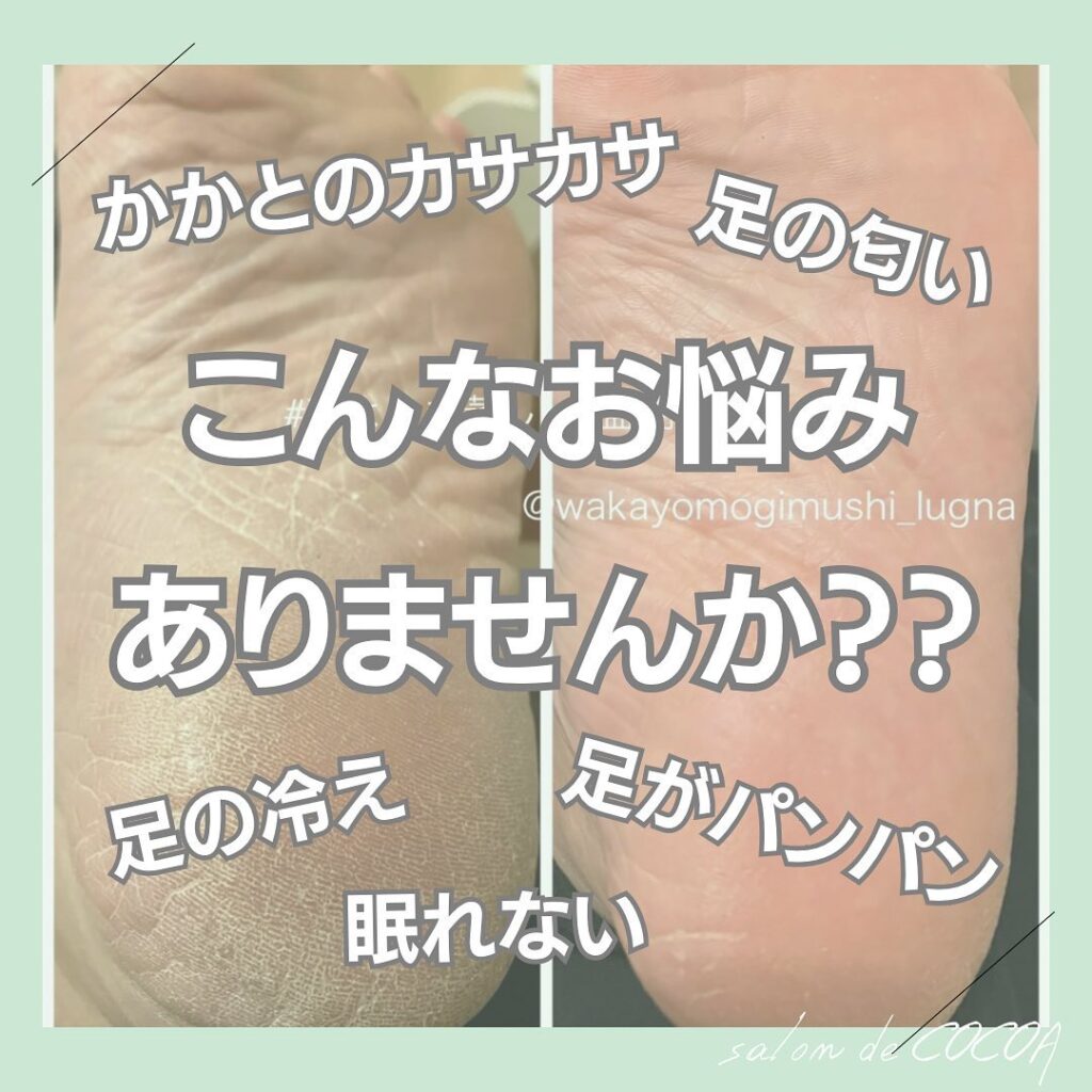 こんなお悩みありませんか？○かかとのカサカサ、ひび割れ○足の臭い○冷え○眠れない○足がパンパンになる○持病などがありよもぎ蒸しにはいれないなどなどそんな方にはお家でもできる若よもぎ蒸しの【足湯】の草をおススメいたします！お写真の方は、寒い日が続き、電気毛布を使い始めて数日で踵がガチガチになったので、足湯の草で15分つけただけで、血色が良くなり、足全体があたたかくなり、踵が柔らかくなりました。